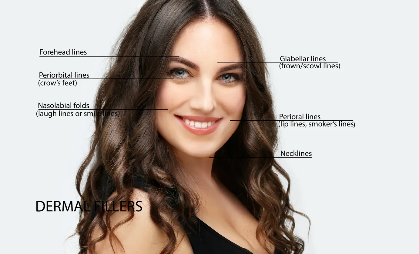 Facial Balancing With Dermal Fillers | Billies Beauty Bar in Boerne, TX